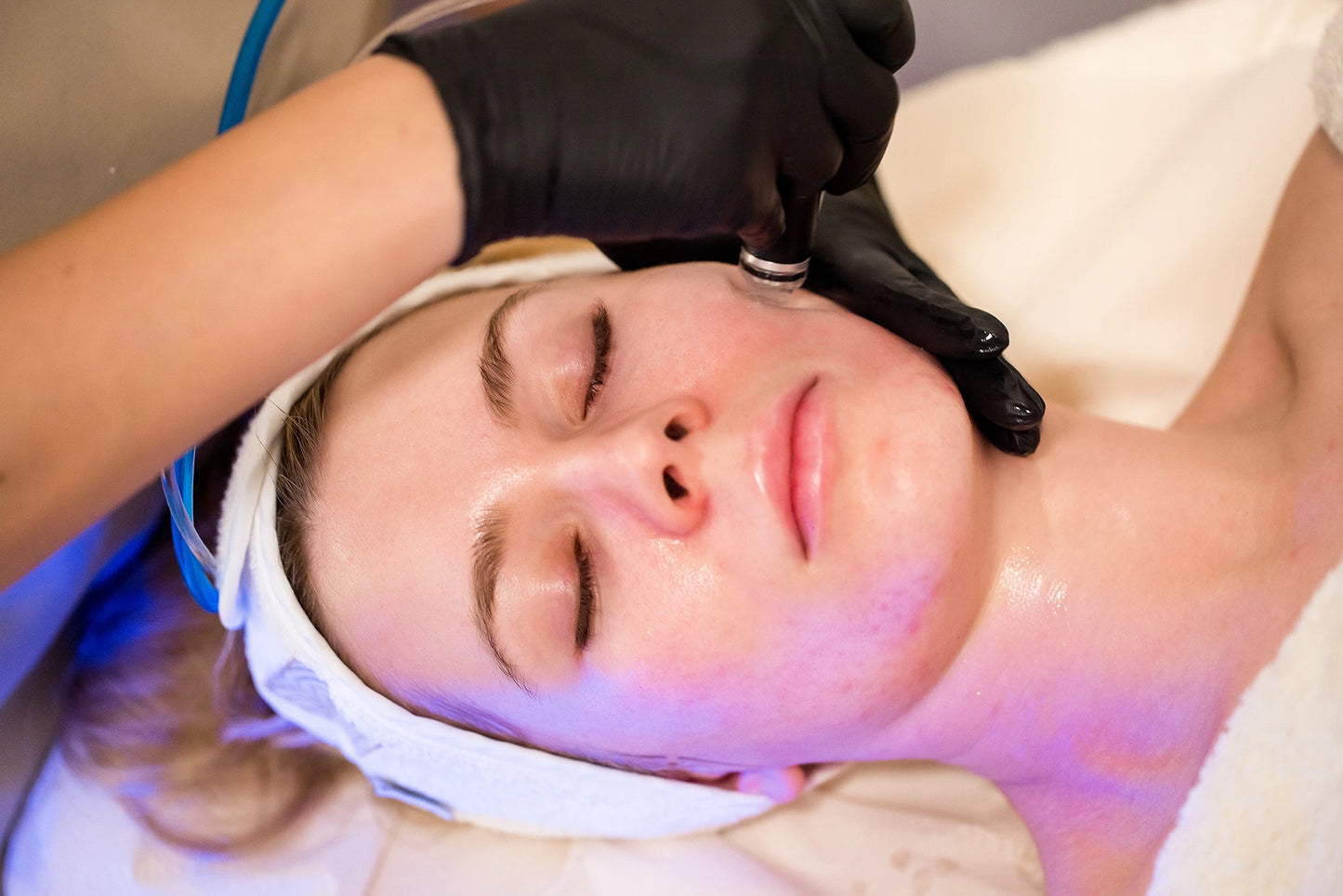 Hello Summer HydraFacial Package- Non Member