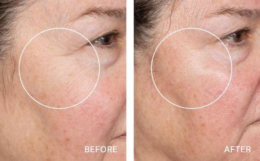Non Member- Deluxe HA Hydralock HydraFacial® – Package of 3