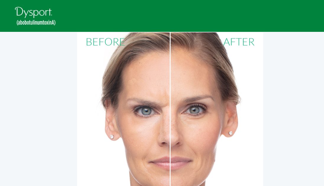 120 Units of Dysport – $399 Active Flawless Members receive a FREE Dysport Lip Flip with purchase!