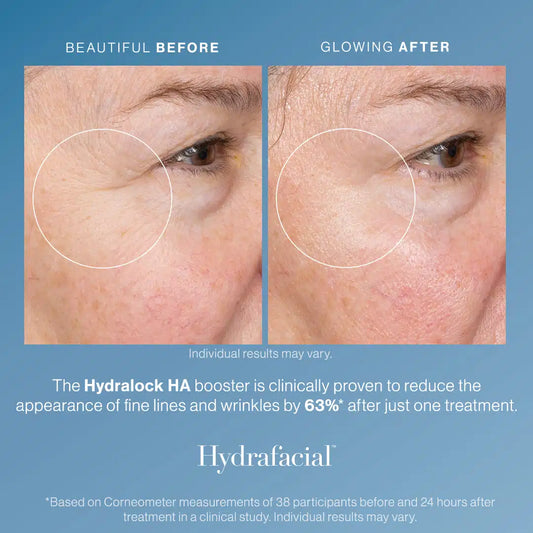 Member - Deluxe HA Hydralock HydraFacial® – Package of 3