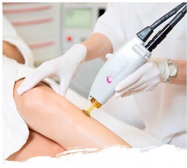 6 Laser Hair Removal Sessions - Full Legs (Holiday Special)