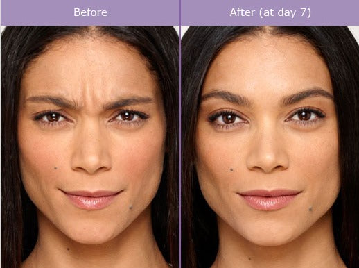 Flawless Medspa Norwell Mother's Day