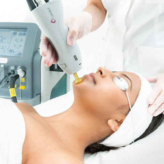Non Member- Upper Lip & Chin Laser Hair Removal