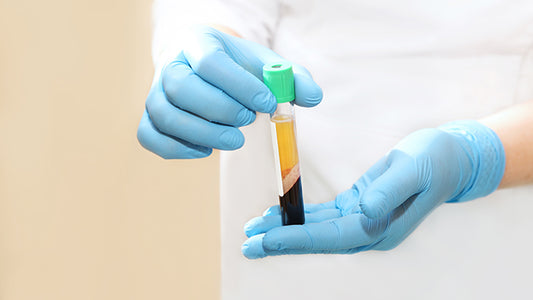 On the 4th day of Christmas … PRP Hair Restoration- Package of 3 Treatments